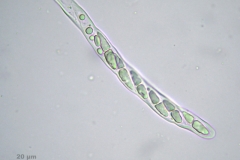Icmadophila_ericetorum-Ascus-c