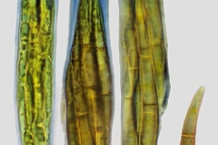 Peltigera_membranacea-H254-1000x-CR