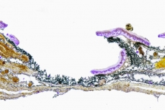 Parmeliella_triptophylla-QS-Lacto-100x